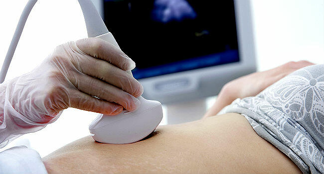 Read more about the article O que é gravidez molar?