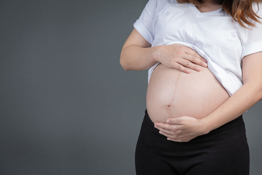 Read more about the article Útero retrovertido pode afetar a gravidez?