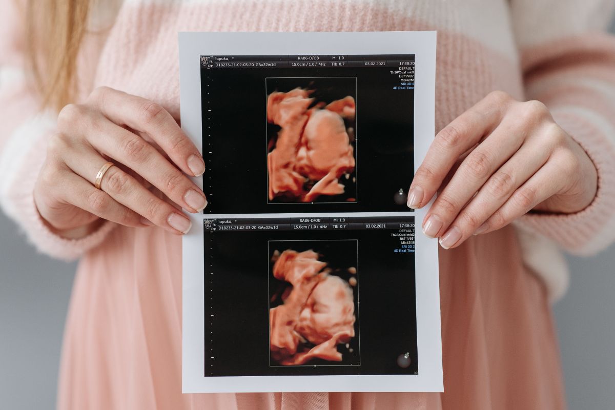Você está visualizando atualmente Ultrassom 5D: a tecnologia perfeita para você ver o rostinho do seu bebê